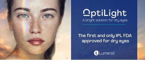 Optilight banner image
